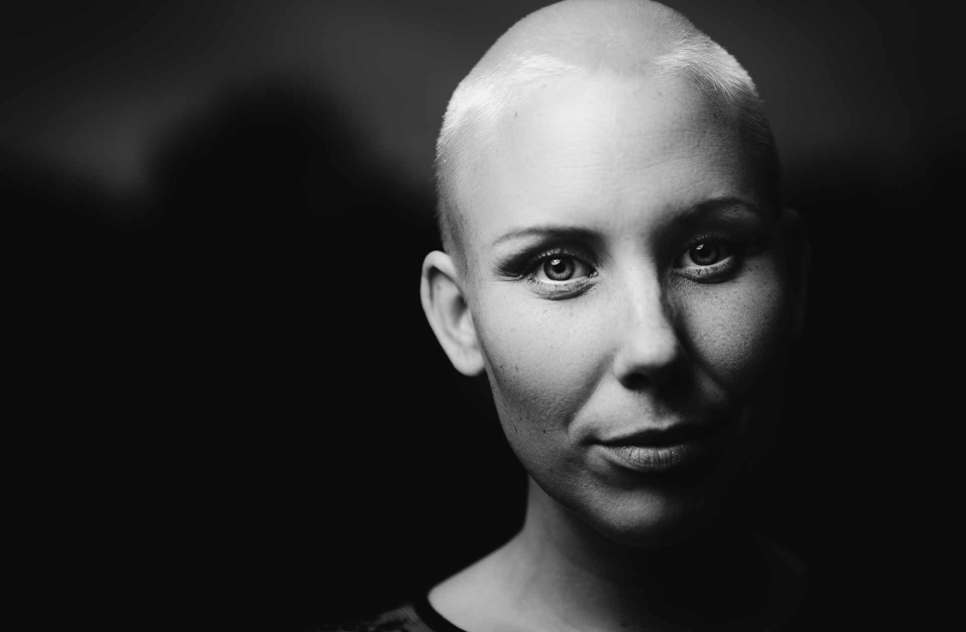 woman with shaved head